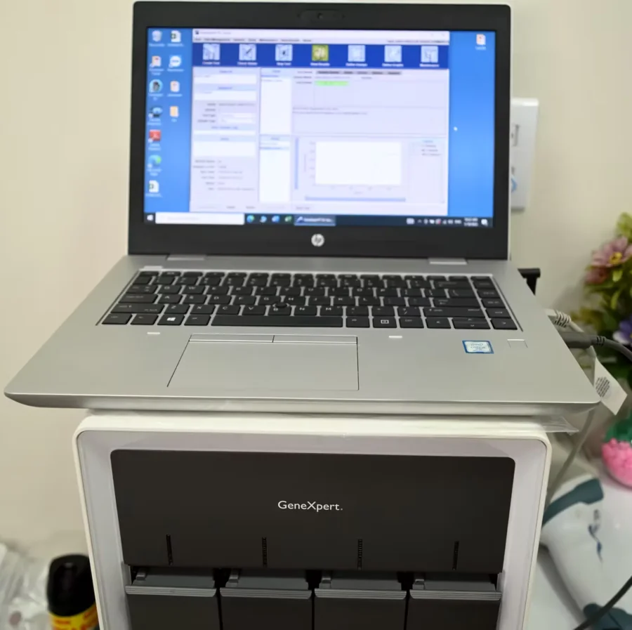 GeneXpert — área técnica do LabCentro
